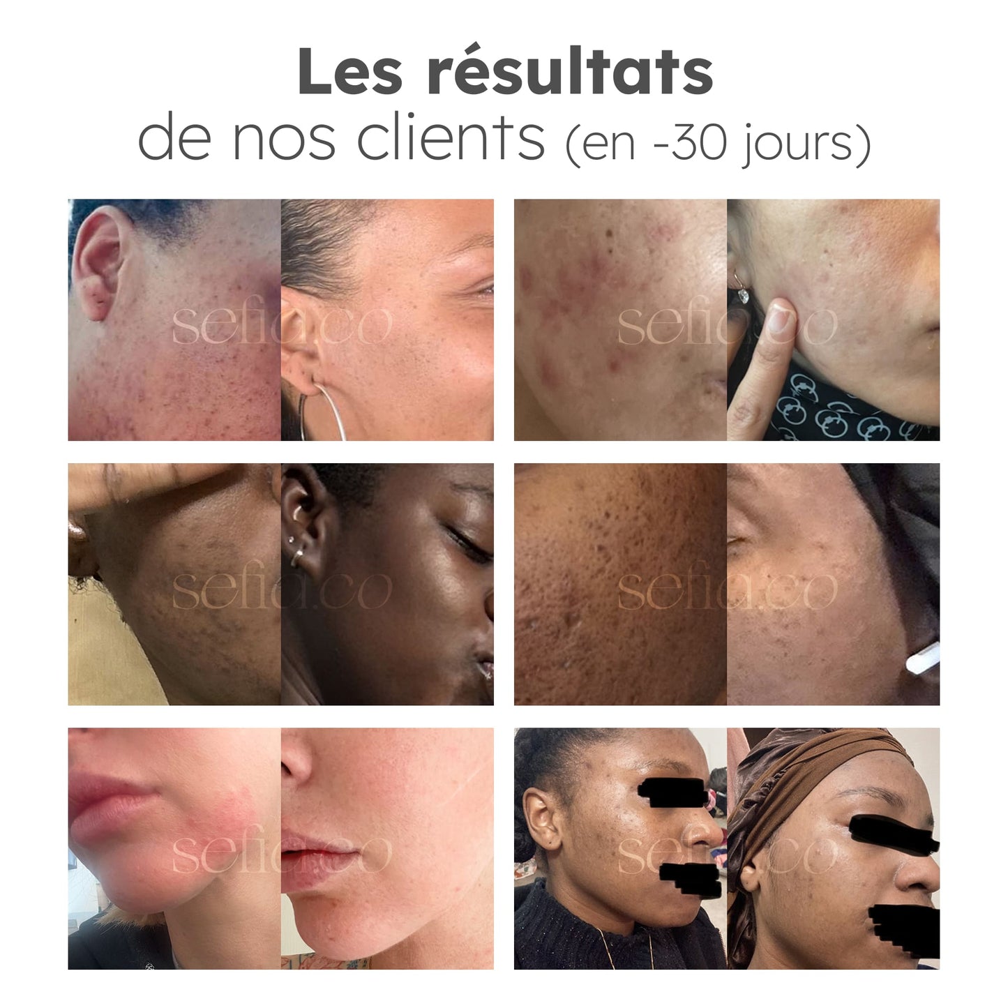 Nettoyant Éclat au Curcuma - 100ml
