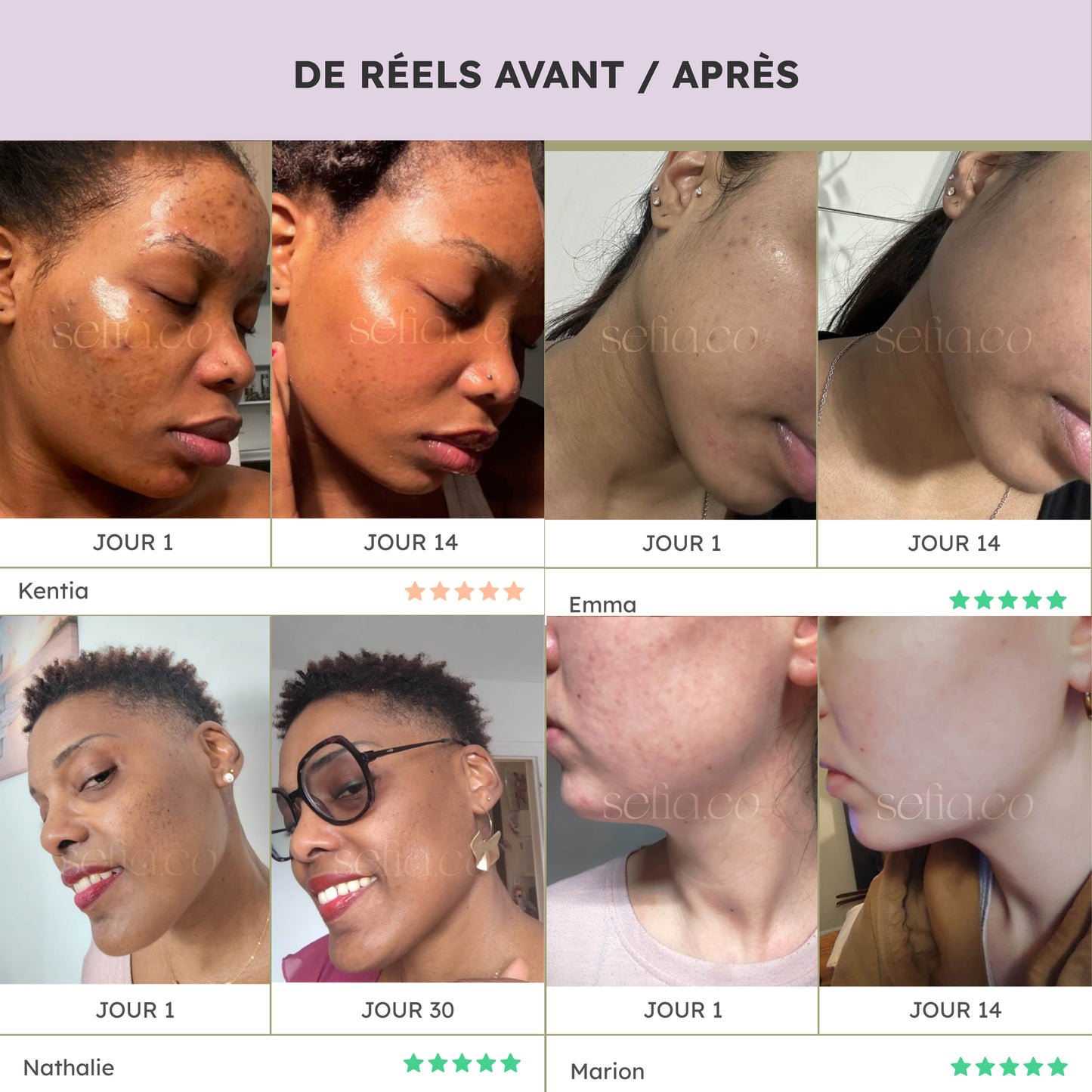 Ultra Glow – Routine 5 produits