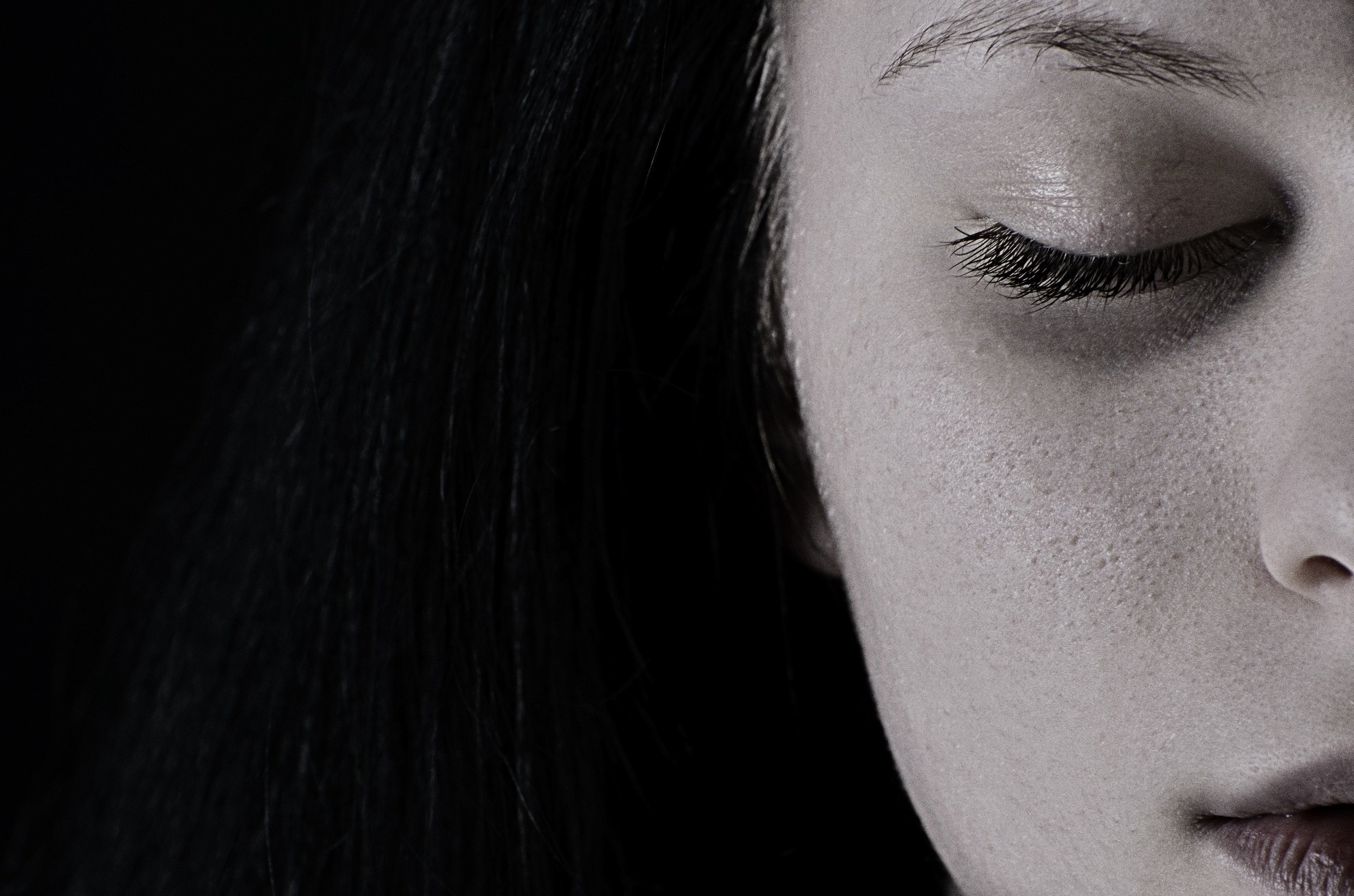 Hyperpigmentation peau noire : causes et solutions Imagen