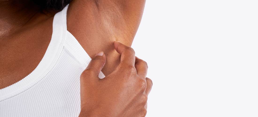 Aisselles foncées et taches entre les cuisses : causes, erreurs à éviter et solutions Image