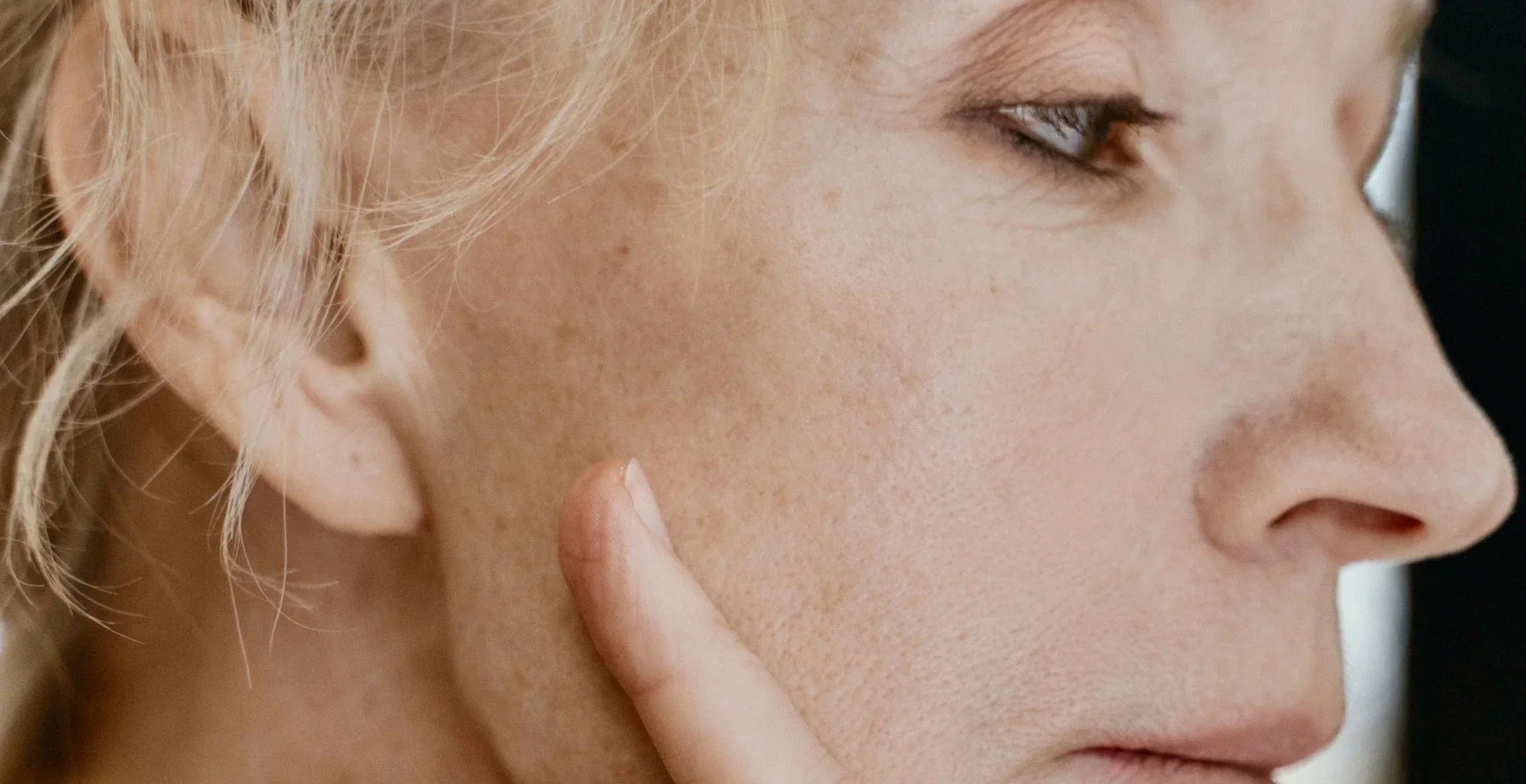Comment enlever les taches brunes sur le visage : la méthode simple pour un teint plus uniforme Imagen