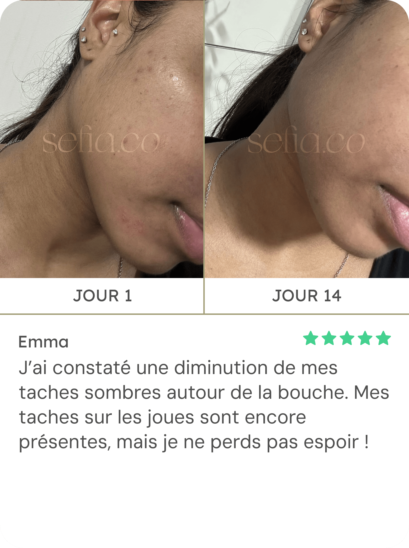Sérum Visage Derma Co à L'acide Kojique 2% - Anti-taches Et Pigmentation, 10ml, Neuf, Exp. Déc. 2027