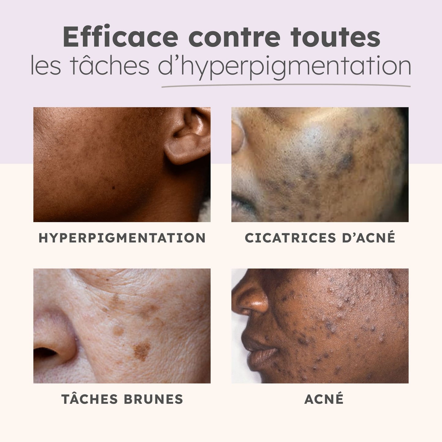 Routine complète anti-imperfections