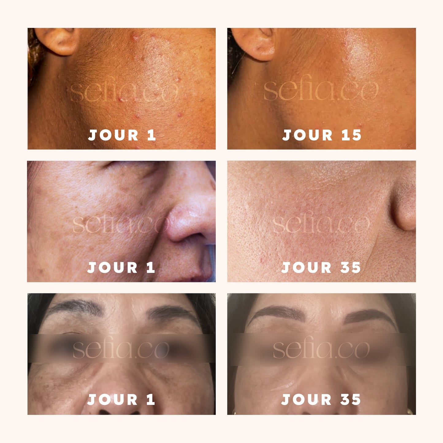 Routine complète anti-imperfections