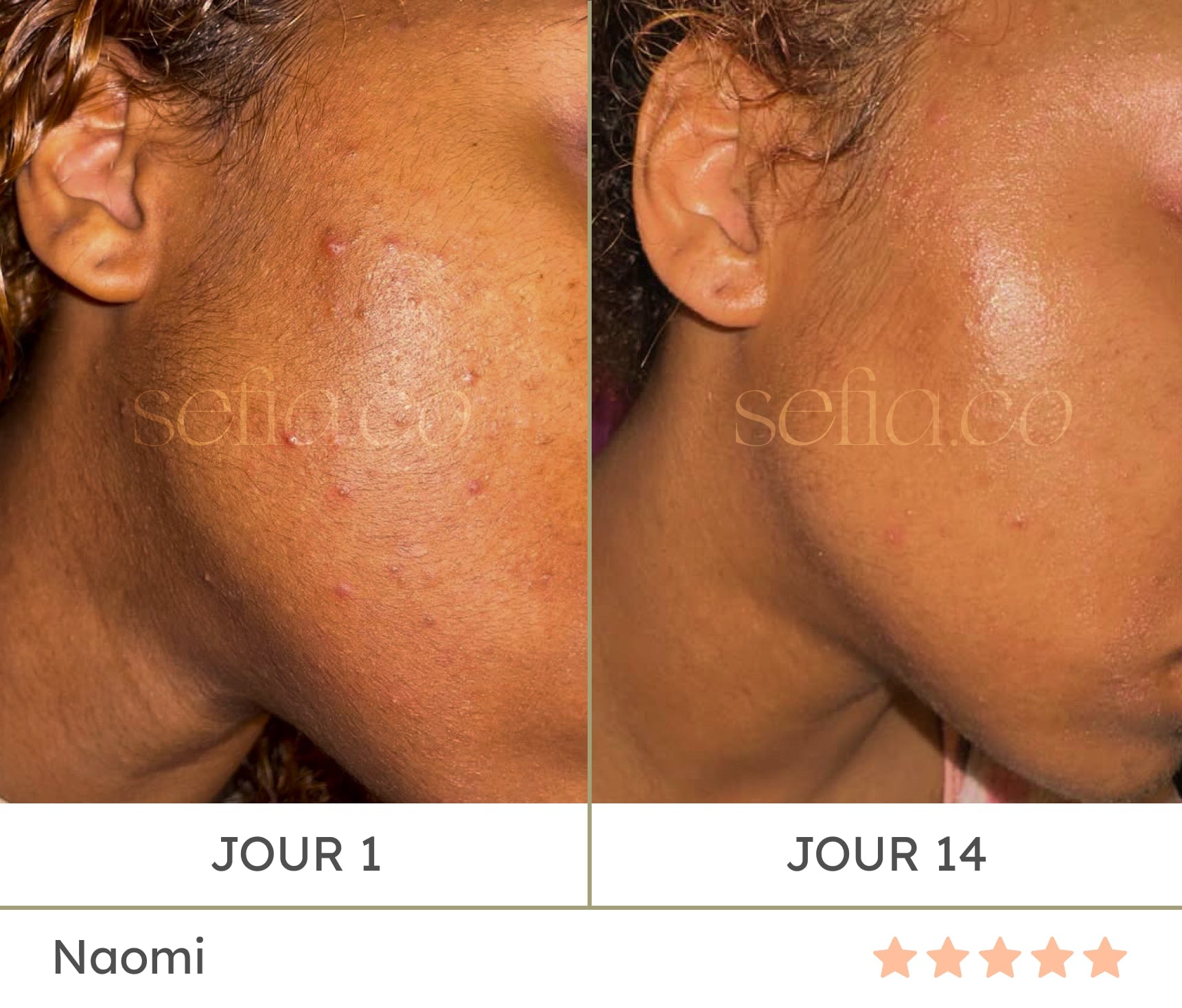 Sérum Visage Anti-taches Brunes à L'acide Kojique Et Mandélique - 15 Ml | Neuf