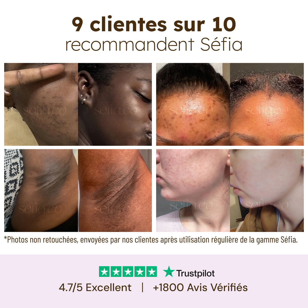 Sérum Éclat anti-taches au curcuma et à la vitamine C