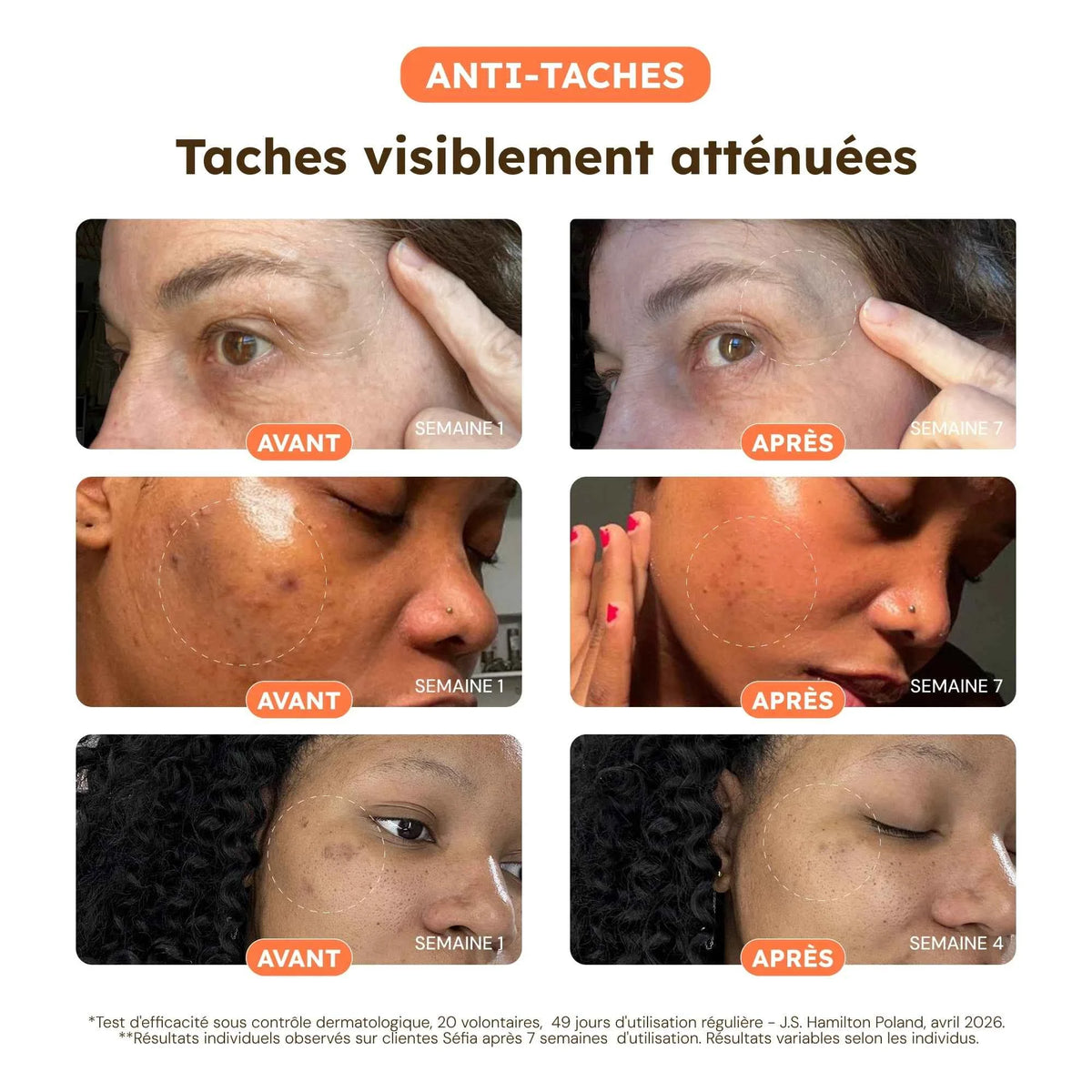 Cotons Anti-Taches