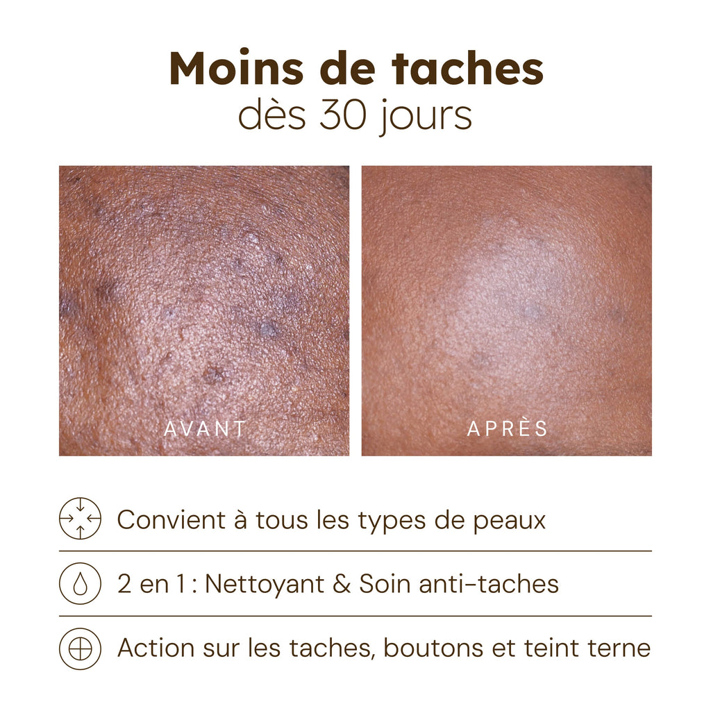 Cotons Anti-Imperfections