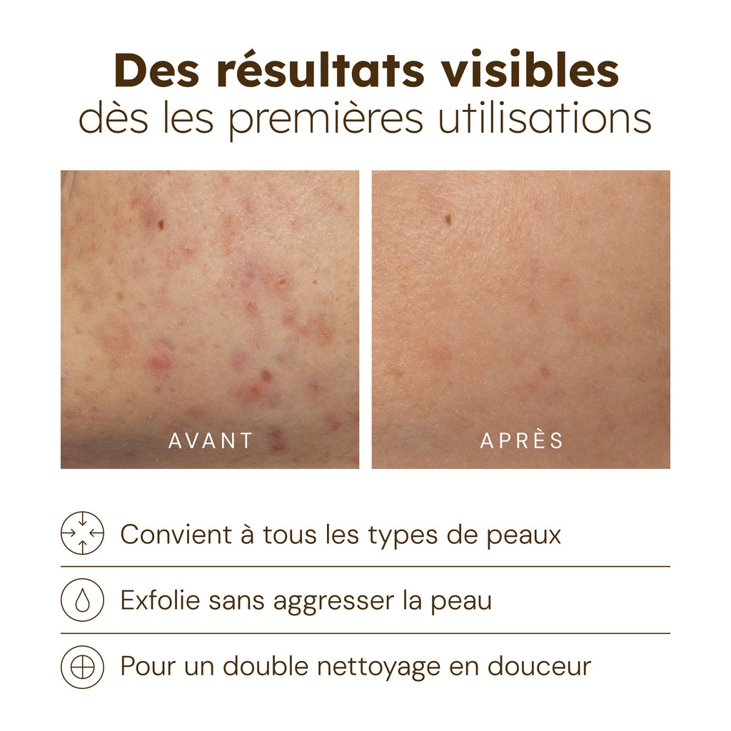 Nettoyant Éclat au Curcuma